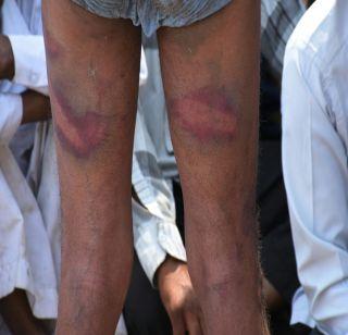 Police farmers beat them as they took water from the canal | कालव्यातून पाणी घेतलं म्हणून पोलिसांची शेतक-यांना मारहाण Police farmers beat them as they took water from the canal | कालव्यातून पाणी घेतलं म्हणून पोलिसांची शेतक-यांना मारहाण
