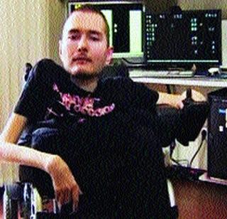 This year will be the first head transplant in the world | यावर्षी होणार जगातील पहिले शीर प्रत्यारोपण This year will be the first head transplant in the world | यावर्षी होणार जगातील पहिले शीर प्रत्यारोपण