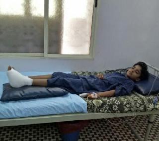 VIDEO: Two children were injured in a chemical explosion in Aurangabad | VIDEO: औरंगाबादमध्ये केमिकल स्फोटात दोन मुलं जखमी