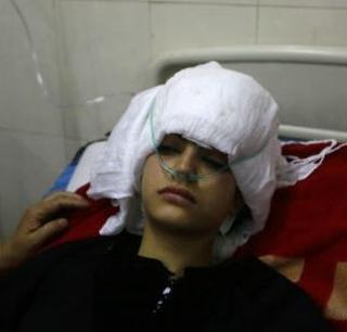 Again, the determination of the injured student is not going to agitate | पुन्हा आंदोलन करणार नाही, दगडफेकीत जखमी विद्यार्थिनीचा निर्धार Again, the determination of the injured student is not going to agitate | पुन्हा आंदोलन करणार नाही, दगडफेकीत जखमी विद्यार्थिनीचा निर्धार