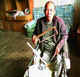 The legs cut off the love of the wife | पत्नीवरील प्रेमापोटी कापला पाय The legs cut off the love of the wife | पत्नीवरील प्रेमापोटी कापला पाय