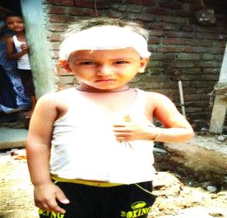 The explosion of the electricity channel, one injured with the chimudra | वीज वाहिनीचा स्फोट , चिमुरड्यासह एक जखमी The explosion of the electricity channel, one injured with the chimudra | वीज वाहिनीचा स्फोट , चिमुरड्यासह एक जखमी