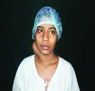 Half a kilo of the neck is removed | मानेवरील अर्ध्या किलोची गाठ काढली