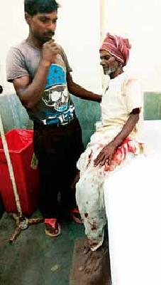 Farmer serious in Randukar attack | रानडुकराच्या हल्ल्यात शेतकरी गंभीर