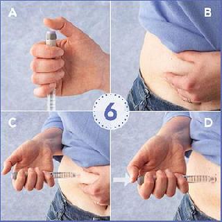 Good news for diabetic patients Let's get rid of insulin injections now | डायबेटिस पेशंट्ससाठी खुशखबर. इन्सुलिनच्या इंजेक्शनला द्या आता सुट्टी Good news for diabetic patients Let's get rid of insulin injections now | डायबेटिस पेशंट्ससाठी खुशखबर. इन्सुलिनच्या इंजेक्शनला द्या आता सुट्टी