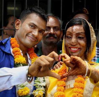 Life partner married to acid attack victim | राँग नंबरमुळे अॅसिड हल्ला पीडितेला मिळाला जीवनसाथी Life partner married to acid attack victim | राँग नंबरमुळे अॅसिड हल्ला पीडितेला मिळाला जीवनसाथी