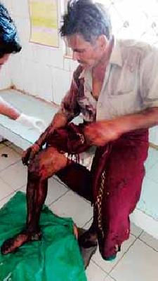 Aslavi attacks in Melghat increased | मेळघाटात अस्वलीचे हल्ले वाढले