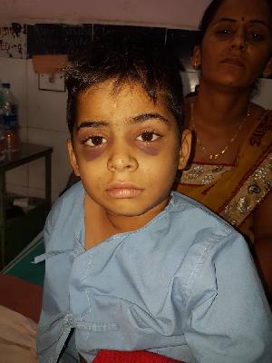Ahmednagar schoolgirl inhumanly beaten Kolhapur | अहमदनगरच्या शाळकरी मुलास कोल्हापूरात अमानुष मारहाण