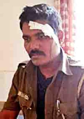 Both the attackers attacked the forest | वनरक्षकावर दोघांनी केला प्राणघातक हल्ला