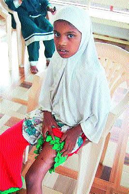 Wandering dogs | भटक्या कुत्र्यांची दहशत