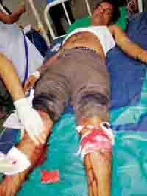 Attack on the journalist | पत्रकारावर प्राणघातक हल्ला Attack on the journalist | पत्रकारावर प्राणघातक हल्ला