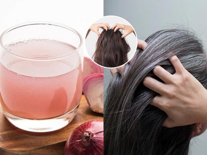 Doctor tells amazing benefits of applying onion juice to your hair for 4 weeks | फक्त २ आठवडे केसांवर लावा कांद्याचा रस, मग बघा कमाल; केस होतील काळे, गळणेही थांबतील
