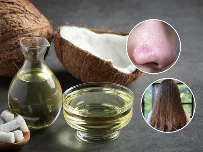 Coconut oil is powerful nourishment for hair and skin, see which combination works like magic | खोबरेल तेलाचे ३ दोस्त म्हणजे केस आणि त्वचेसाठी पॉवरफुल पोषण, पाहा कोणते मिश्रण कधी वापरले की होते जादू Coconut oil is powerful nourishment for hair and skin, see which combination works like magic | खोबरेल तेलाचे ३ दोस्त म्हणजे केस आणि त्वचेसाठी पॉवरफुल पोषण, पाहा कोणते मिश्रण कधी वापरले की होते जादू