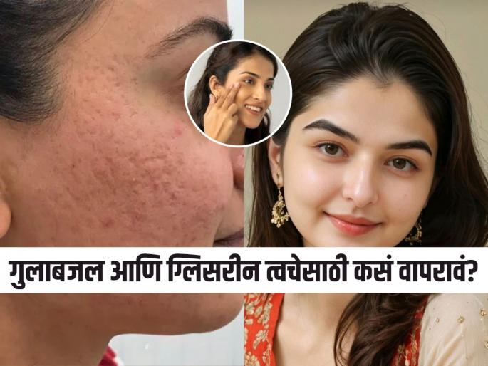 how to get rid of open pores and pigmentation, home remedies for dry skin, home hacks for dark circles and dark lips  | ओपन पोअर्समुळे चेहरा खराब दिसतो? गुलाबजल आणि ग्लिसरीन 'या' पद्धतीने लावा, पिगमेंटेशनही जातील 