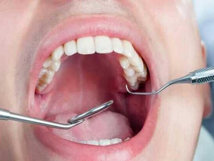 Ignoring these mouth problems can be reason diabetes myb | तोंडाच्या 'या' समस्या ठरू शकतात डायबिटीसचं कारण, दुर्लक्ष करणं पडेल महागात Ignoring these mouth problems can be reason diabetes myb | तोंडाच्या 'या' समस्या ठरू शकतात डायबिटीसचं कारण, दुर्लक्ष करणं पडेल महागात