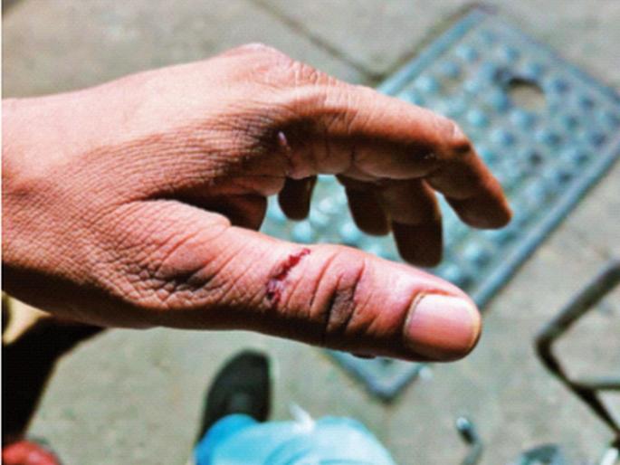 Police sub-inspector assaulted in Bandra for covering drunkards who were arguing | PSI च्या अंगठ्याला दारुड्याने घेतला चावा; भाभा रुग्णालयाच्या डॉक्टरनाही शिवीगाळ Police sub-inspector assaulted in Bandra for covering drunkards who were arguing | PSI च्या अंगठ्याला दारुड्याने घेतला चावा; भाभा रुग्णालयाच्या डॉक्टरनाही शिवीगाळ