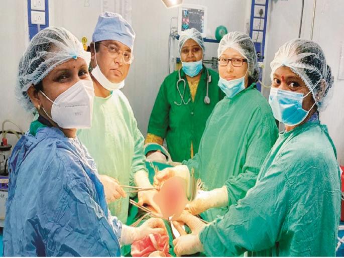 OMG... a lump of 1.5 kg in the abdomen, a lakh surgeries were performed for 260 rupees in Government District Hospital | अबब...पोटात दीड किलोचा गोळा; दीड तास चालली शस्त्रक्रिया, खर्च केवळ २६० रुपये OMG... a lump of 1.5 kg in the abdomen, a lakh surgeries were performed for 260 rupees in Government District Hospital | अबब...पोटात दीड किलोचा गोळा; दीड तास चालली शस्त्रक्रिया, खर्च केवळ २६० रुपये
