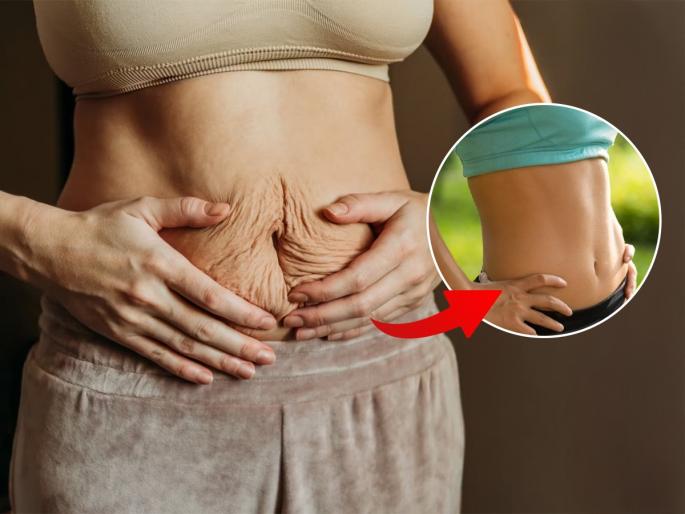 Best home remedies to reduce belly fat after delivery naturally How to lose baby belly fat without exercise Foods to eat after pregnancy to reduce belly fat | बाळंतपणानंतर वाढलेले पोट कसे कमी कराल? ४ उपाय- पोटाचा वाढलेला घेर होईल कमी