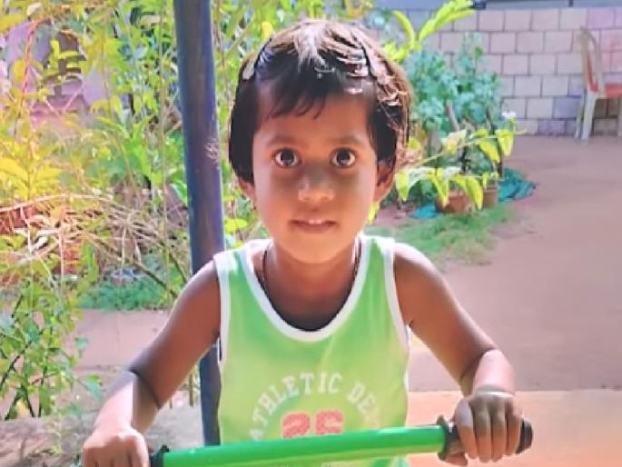 Kolhapurites help Ovi Sagar Pujari of Hatkanangle taluka for treatment of rare disease SSPE. Congress leader Satej Patil provided immediate assistance of Rs. 25000 | ओवीसाठी कोल्हापूरकरांनी दातृत्व दाखविले, एसएसपीई या दुर्मीळ आजाराने ग्रस्त Kolhapurites help Ovi Sagar Pujari of Hatkanangle taluka for treatment of rare disease SSPE. Congress leader Satej Patil provided immediate assistance of Rs. 25000 | ओवीसाठी कोल्हापूरकरांनी दातृत्व दाखविले, एसएसपीई या दुर्मीळ आजाराने ग्रस्त