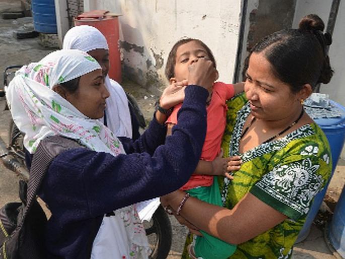 Polio in homeless children | वंचित बालकांना घरोघरी पोलिओ