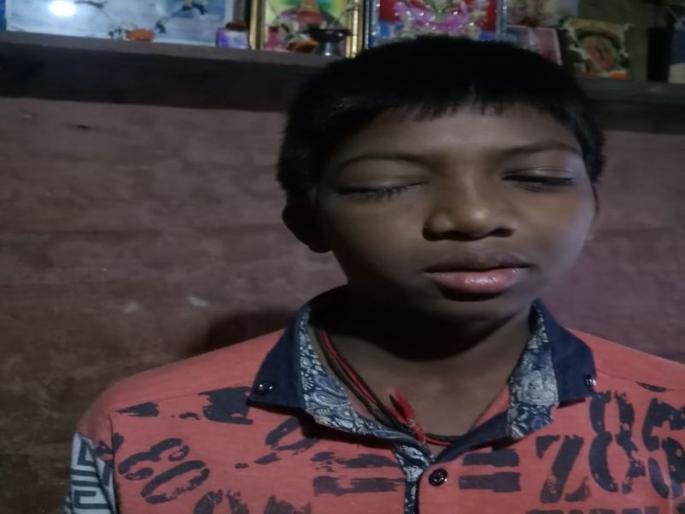 The teacher kicked the wings in the classroom, the teacher beat him severely | वर्गात पंख लावल्याने शिक्षकाने विद्यार्थ्याला केली बेदम मारहाण 