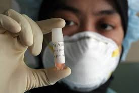 pandemic diseases 159 villages in Akola district! | पावसाळयात अकोला जिल्ह्यातील १५९ गावांमध्ये साथरोगाचा धोका! pandemic diseases 159 villages in Akola district! | पावसाळयात अकोला जिल्ह्यातील १५९ गावांमध्ये साथरोगाचा धोका!