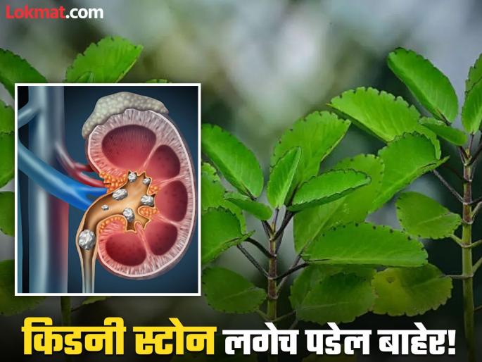 How to use Panfuti leaf for kidney stone and stomach pain home remedies | 'या' एका आयुर्वेदिक उपायने किडनी स्टोनचे होतील तुकडे तुकडे, जाणून घ्या कसा कराल वापर! How to use Panfuti leaf for kidney stone and stomach pain home remedies | 'या' एका आयुर्वेदिक उपायने किडनी स्टोनचे होतील तुकडे तुकडे, जाणून घ्या कसा कराल वापर!