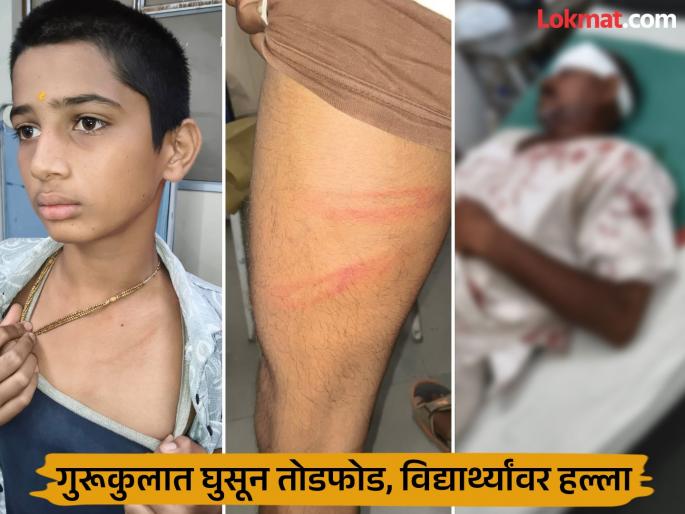 Beed Crime: Students were severely beaten after entering a Gurukul in Parli, the driver's father was also attacked | Beed Crime: परळीत गुरूकुलात घुसून विद्यार्थ्यांना जबर मारहाण, चालकाच्या वडिलांवरही हल्ला Beed Crime: Students were severely beaten after entering a Gurukul in Parli, the driver's father was also attacked | Beed Crime: परळीत गुरूकुलात घुसून विद्यार्थ्यांना जबर मारहाण, चालकाच्या वडिलांवरही हल्ला