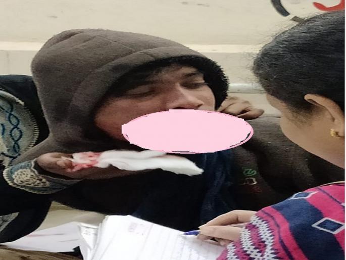 Shocking! Youth were seriously injured after being cracker blast in the mouth in a train's toilet | धक्कादायक ! तोंडात फटाका फुटल्याने युवक गंभीर जखमी; रेल्वेतील टॉयलेटमध्ये घडली घटना Shocking! Youth were seriously injured after being cracker blast in the mouth in a train's toilet | धक्कादायक ! तोंडात फटाका फुटल्याने युवक गंभीर जखमी; रेल्वेतील टॉयलेटमध्ये घडली घटना