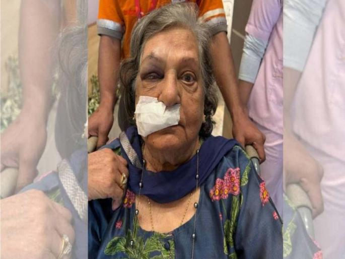 Air India did not provide wheelchair to 82 year old woman fell in airport premises | मागणी केली; पण व्हीलचेअर न दिल्याने आजीबाई पडल्या Air India did not provide wheelchair to 82 year old woman fell in airport premises | मागणी केली; पण व्हीलचेअर न दिल्याने आजीबाई पडल्या