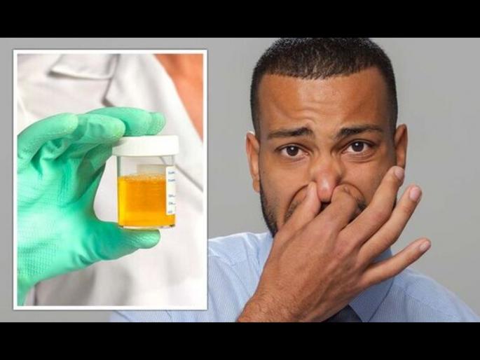 Urine odor : Know about unusual smell of urine | तुमच्या लघवीतून अशाप्रकारची दुर्गंधी येते का? या आजारांचा असू शकतो संकेत Urine odor : Know about unusual smell of urine | तुमच्या लघवीतून अशाप्रकारची दुर्गंधी येते का? या आजारांचा असू शकतो संकेत