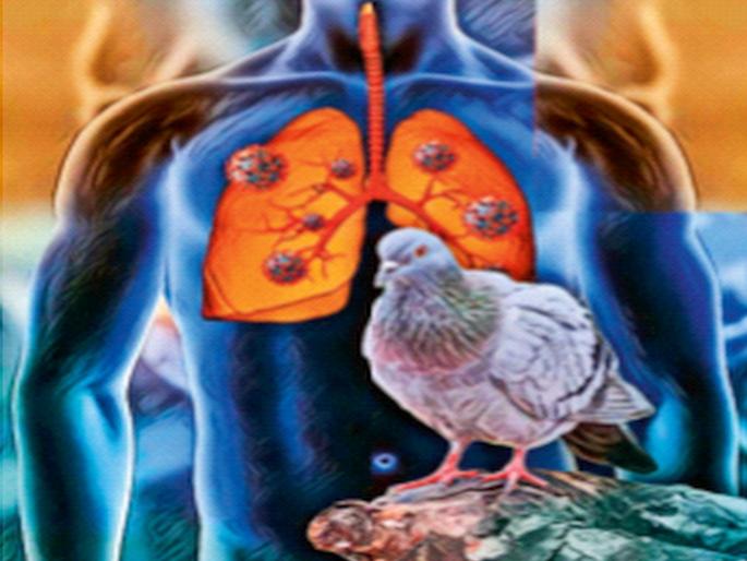 Pigeons' behavior can cause serious lung diseases; Seek timely treatment: Experts appeal | कबुतरांच्या वावरामुळे फुप्फुसाच्या गंभीर व्याधी; वेळीच उपचार घ्या : तज्ज्ञांचे आवाहन Pigeons' behavior can cause serious lung diseases; Seek timely treatment: Experts appeal | कबुतरांच्या वावरामुळे फुप्फुसाच्या गंभीर व्याधी; वेळीच उपचार घ्या : तज्ज्ञांचे आवाहन