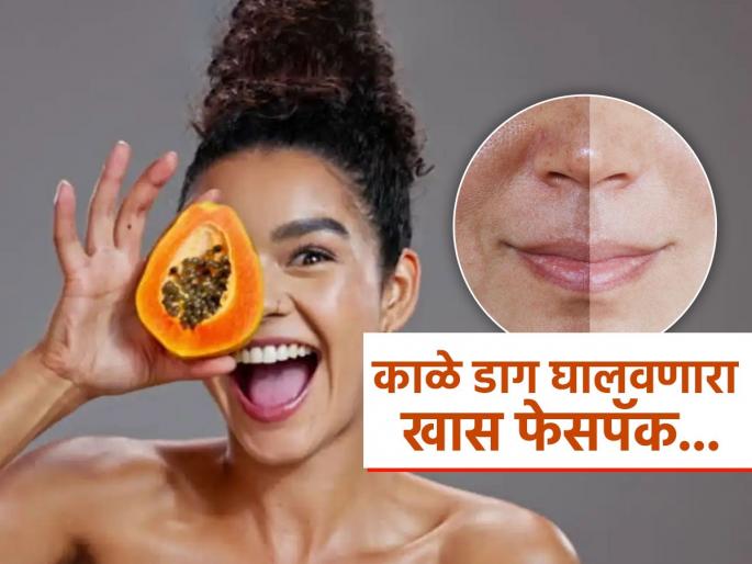 Natural face pack to get rid of pigmentation | काळ्या डागांमुळे दिसतो चेहरा विद्रूप, ‘हा’ नॅचरल उपाय करा; डाग गायब-चेहऱ्यावर येतं तेज