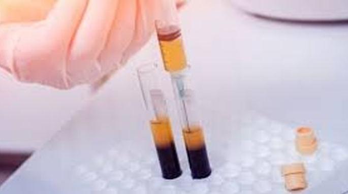 Plasma therapy is not yet implemented in Amravati division! | अमरावती विभागात ‘प्लाझ्मा थेरपी’ची अद्याप अंमलबजावणी नाही! Plasma therapy is not yet implemented in Amravati division! | अमरावती विभागात ‘प्लाझ्मा थेरपी’ची अद्याप अंमलबजावणी नाही!