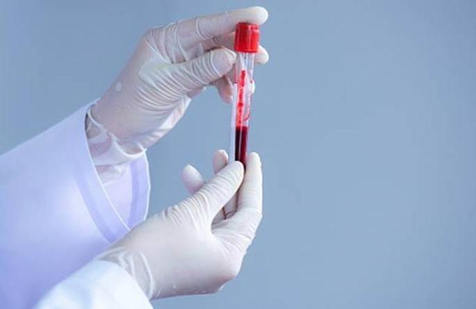 Plasma Therapy has more than just a set of rules! | ‘प्लाझ्मा थेरपी’ला नियमांचे अडथळेच जास्त! Plasma Therapy has more than just a set of rules! | ‘प्लाझ्मा थेरपी’ला नियमांचे अडथळेच जास्त!