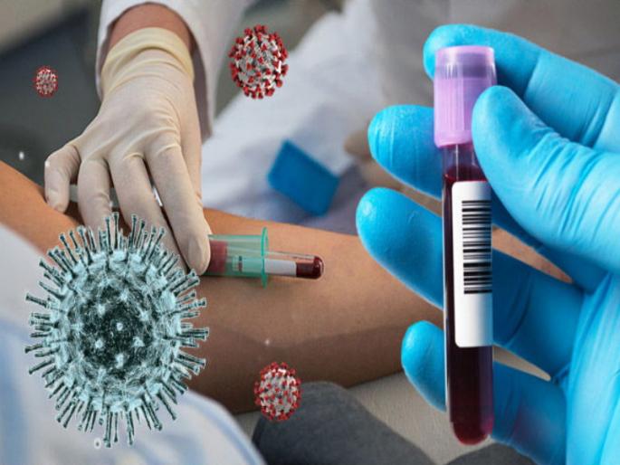 Corona virus : Plasma of AB blood group can be given to patients of other blood groups | Corona virus :'एबी' रक्तगटाचा प्लाझ्मा इतर रक्तगटांच्या कोरोनारूग्णांना देणे शक्य; पण डॉक्टरांचा सल्ला आवश्यक Corona virus : Plasma of AB blood group can be given to patients of other blood groups | Corona virus :'एबी' रक्तगटाचा प्लाझ्मा इतर रक्तगटांच्या कोरोनारूग्णांना देणे शक्य; पण डॉक्टरांचा सल्ला आवश्यक
