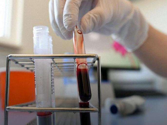 CoronaVirus successful experiment of plasma therapy on four patients | CoronaVirus: प्लाज्मा उपचाराचा चौघांवर यशस्वी प्रयोग CoronaVirus successful experiment of plasma therapy on four patients | CoronaVirus: प्लाज्मा उपचाराचा चौघांवर यशस्वी प्रयोग
