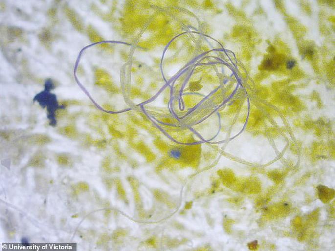 Average person accidentally ingests more than 73000 pieces of microplastics every year | एका वर्षात एका व्यक्तीच्या पोटात जातात प्लॅस्टिकचे 'इतके' हजार कण, आकडा वाचून व्हाल थक्क...