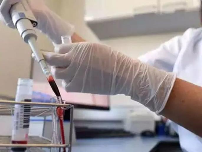 Alternative to plasma therapy in case of drug shortage | औषधांचा तुटवड्यावर प्लाझ्मा थेरपीचा पर्याय Alternative to plasma therapy in case of drug shortage | औषधांचा तुटवड्यावर प्लाझ्मा थेरपीचा पर्याय
