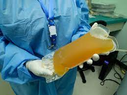 Got a plaza from Pune for a pregnant woman in Kolkata | कोलकत्यावरून गर्भवती महिलेसाठी 'प्लाझ्मा'ची डिमांड; पुण्यातील 'वंदे मातरम संघटने'ची १५ मिनिटांत कमाल Got a plaza from Pune for a pregnant woman in Kolkata | कोलकत्यावरून गर्भवती महिलेसाठी 'प्लाझ्मा'ची डिमांड; पुण्यातील 'वंदे मातरम संघटने'ची १५ मिनिटांत कमाल