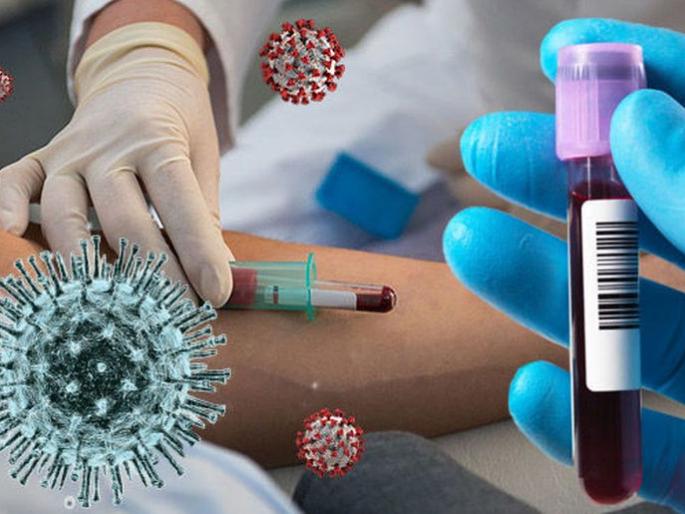 CoronaVirus News: Plasma therapy not effective in reducing corona mortality aiims stusy | चिंता वाढली! कोरोनाचा मृत्यूदर कमी करण्यासाठी प्लाझ्मा थेरेपी निरुपयोगी; संशोधनातून तज्ज्ञांचा दावा CoronaVirus News: Plasma therapy not effective in reducing corona mortality aiims stusy | चिंता वाढली! कोरोनाचा मृत्यूदर कमी करण्यासाठी प्लाझ्मा थेरेपी निरुपयोगी; संशोधनातून तज्ज्ञांचा दावा