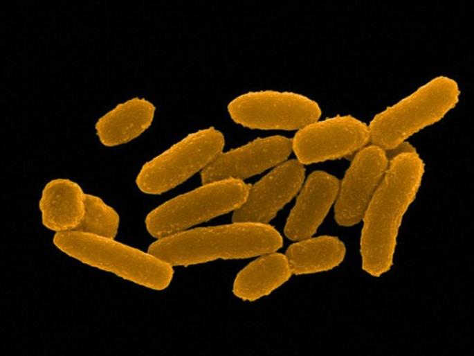 In Madagascar, 23 people have died so far with the plague | मादागास्करमध्ये प्लेगच्या साथीनं आतापर्यंत 23 जणांचा मृत्यू In Madagascar, 23 people have died so far with the plague | मादागास्करमध्ये प्लेगच्या साथीनं आतापर्यंत 23 जणांचा मृत्यू