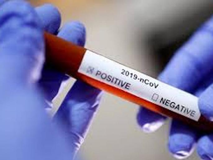 Another victim of Corona; 25 new positive, 20 coronal free | कोरोनाचा आणखी एक बळी; २५ नवे पॉझिटिव्ह, २० कोरोनामुक्त Another victim of Corona; 25 new positive, 20 coronal free | कोरोनाचा आणखी एक बळी; २५ नवे पॉझिटिव्ह, २० कोरोनामुक्त