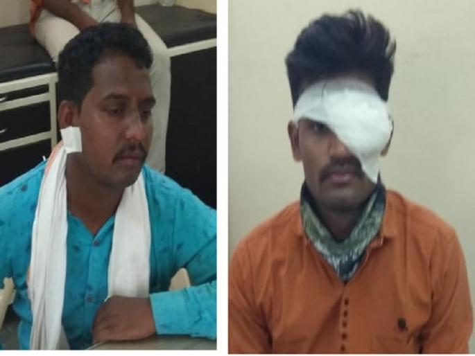 Shocking! The shop opened during the curfew; Crowd attack on police who asking for closure | धक्कादायक ! संचारबंदी काळात दुकान उघडले; बंद करण्यास सांगणाऱ्या पोलिसांवर जमावाचा हल्ला Shocking! The shop opened during the curfew; Crowd attack on police who asking for closure | धक्कादायक ! संचारबंदी काळात दुकान उघडले; बंद करण्यास सांगणाऱ्या पोलिसांवर जमावाचा हल्ला