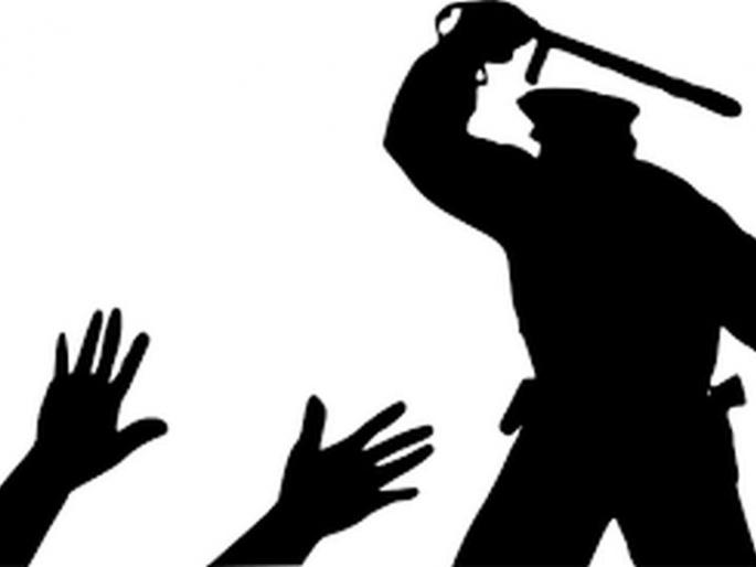 Akola: Ramdaspeth police beaten a youth | अकोला : रामदासपेठ पोलिसाची युवकास बेदम मारहाण Akola: Ramdaspeth police beaten a youth | अकोला : रामदासपेठ पोलिसाची युवकास बेदम मारहाण