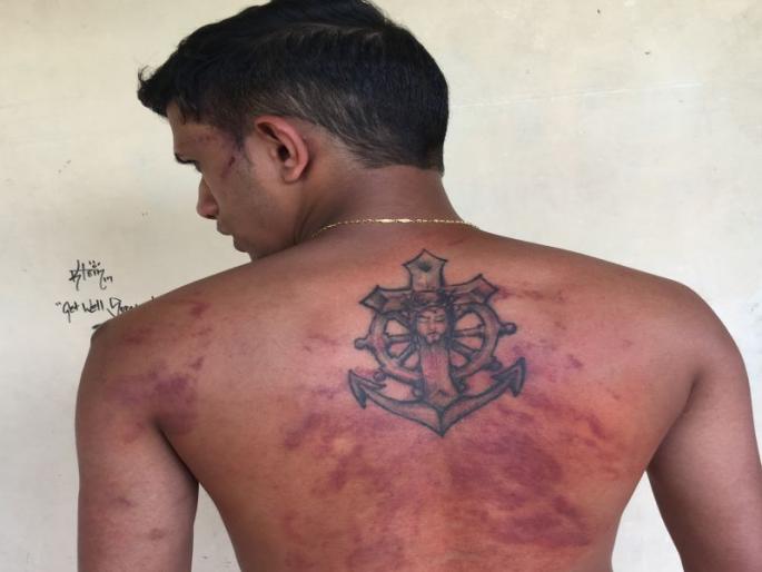 youth alleges that goa police beats him with leather belt | पोलिसांकडून चामड्याच्या पट्ट्यानं बेदम मारहाण केल्याचा तरुणाचा आरोप