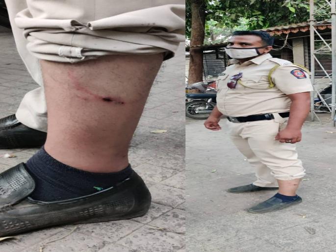 Gangsterism of those who do not use masks; Dogs left on police squad, one policeman injured | मास्क न वापरणाऱ्यांची दादागिरी; पोलीस पथकावर सोडले कुत्रे, एक पोलीस जखमी 