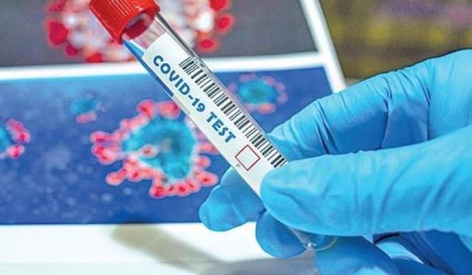 Another 12 corona positive patients were found in Akola district | अकोला जिल्ह्यात आणखी १२ कोरोना पॉझिटिव्ह रुग्ण आढळले Another 12 corona positive patients were found in Akola district | अकोला जिल्ह्यात आणखी १२ कोरोना पॉझिटिव्ह रुग्ण आढळले