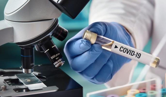 CoronaVirus: Akola district's positivity rate at 12%! | CoronaVirus : अकोला जिल्ह्याचा पॉझिव्हिटी रेट १२ टक्क्यांवर!