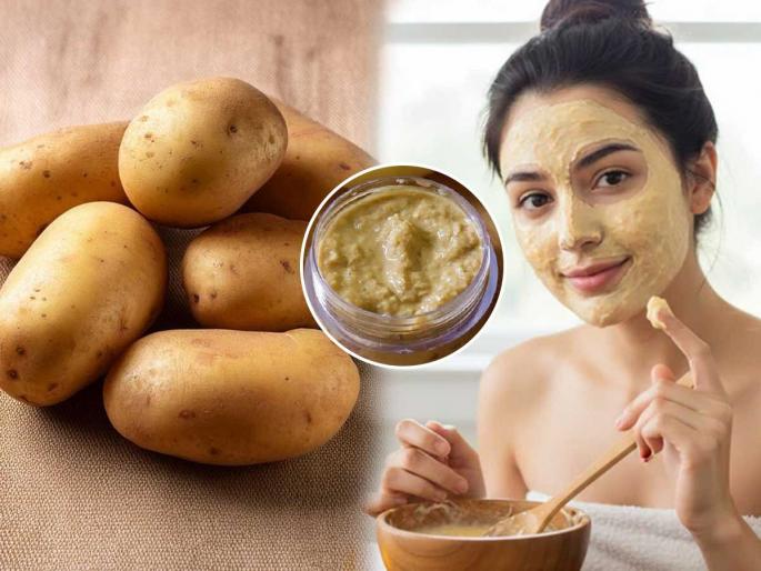 Natural skin treatment at home, DIY potato face mask for better glow | कुठलीच नसेल भाजी तरी बटाटा राजी हे जितकं खरं तितकाच बटाटा असरदार त्वचाविकारांवर, पाहा उपाय Natural skin treatment at home, DIY potato face mask for better glow | कुठलीच नसेल भाजी तरी बटाटा राजी हे जितकं खरं तितकाच बटाटा असरदार त्वचाविकारांवर, पाहा उपाय